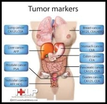 Xét nghiệm dấu ấn khối u - Tumor markers